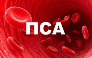 Что такое уровень пса в урологии