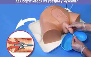 Больно писать после мазка из уретры