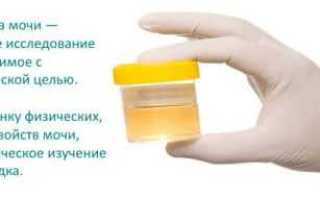 Что можно и нельзя перед сдачей мочи на анализ?