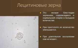 Лецитиновые зерна в секрете простаты: норма и отклонения