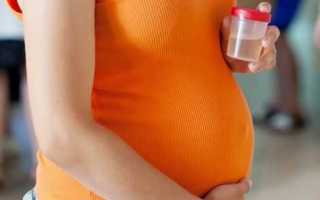 Норма лейкоцитов в моче у женщин после 40-50 лет
