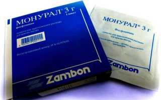 Что такое монурель в урологии