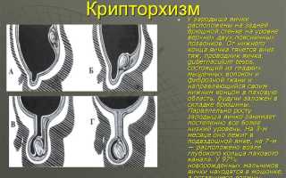 Детский уролог-андролог. Платный прием. Детская поликлиника Литфонда.