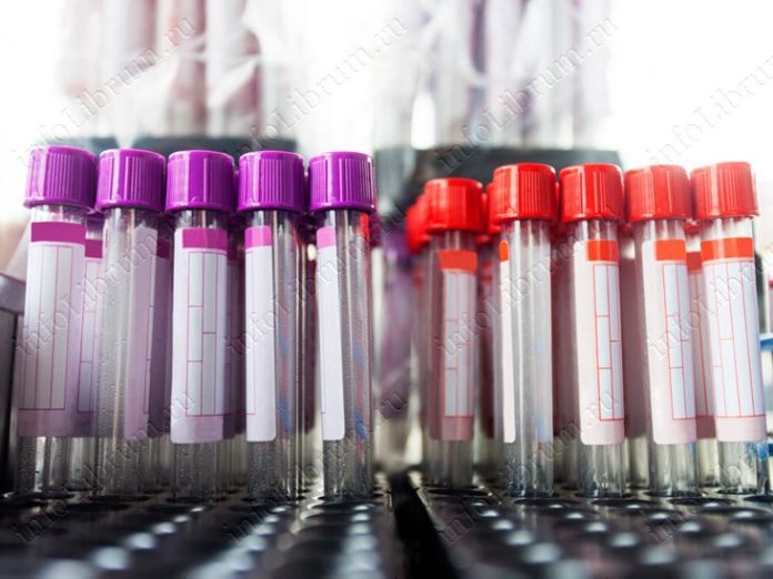 creatinine-blood_thumb-696x522-1